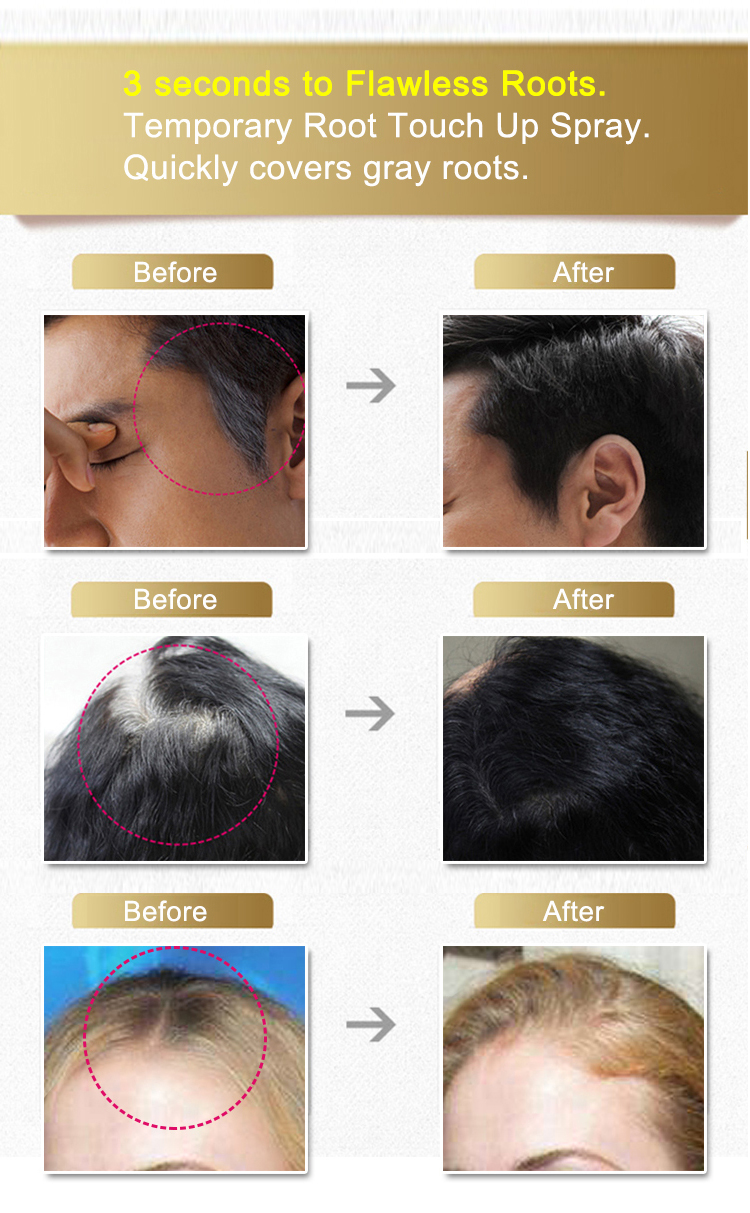 Plaukų spalvos šaknų pataisymas Instant Hair Root Cover Up Spray-5
