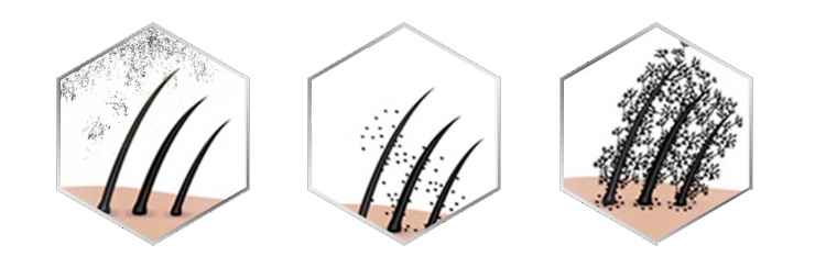 Biezu šķiedru matu veidošanas šķiedru izsmidzinātājs matu šķiedra-7